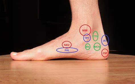 Heel Hurts When Running: Exploring the Mysteries of Foot Pain and Beyond